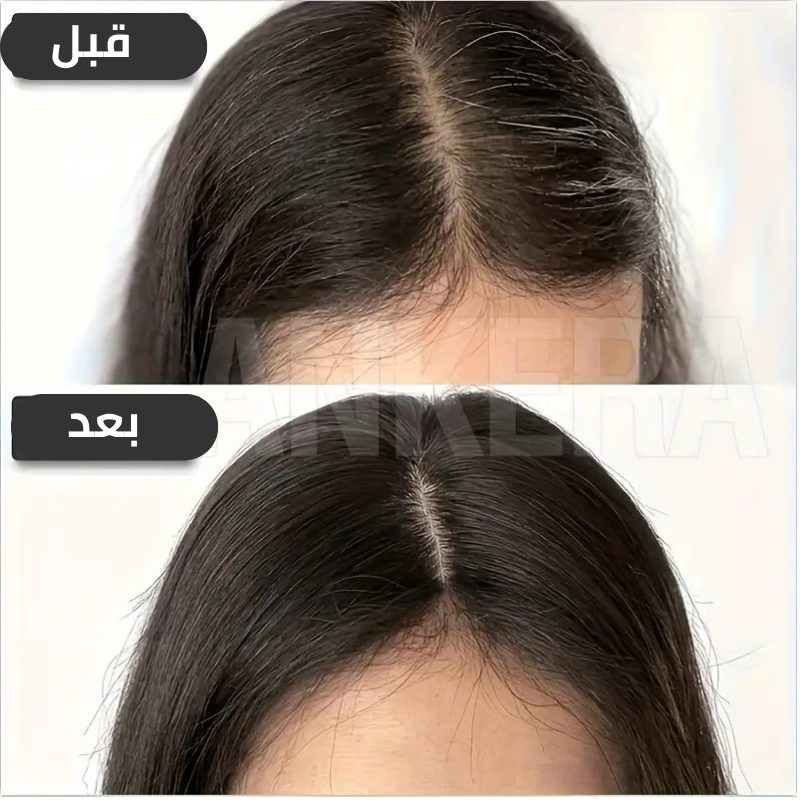 بروتاز شعر طبيعي silkbase مقاس5*9 سم