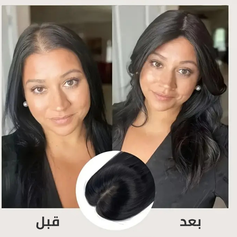بروتاز شعر طبيعي دونتال  مقاس5*6 سم